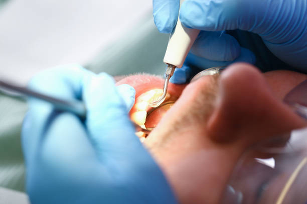 Best Emergency Dental Filling Replacement  in Colon, MI