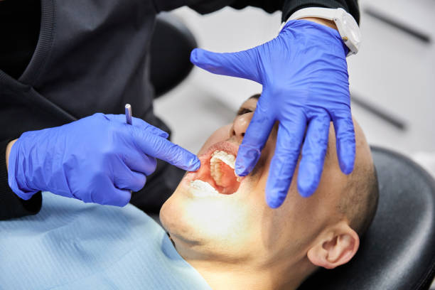 Best Chipped Tooth Repair Near Me  in Colon, MI