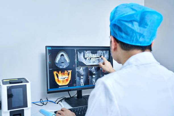 Best Urgent Tooth Repair  in Colon, MI